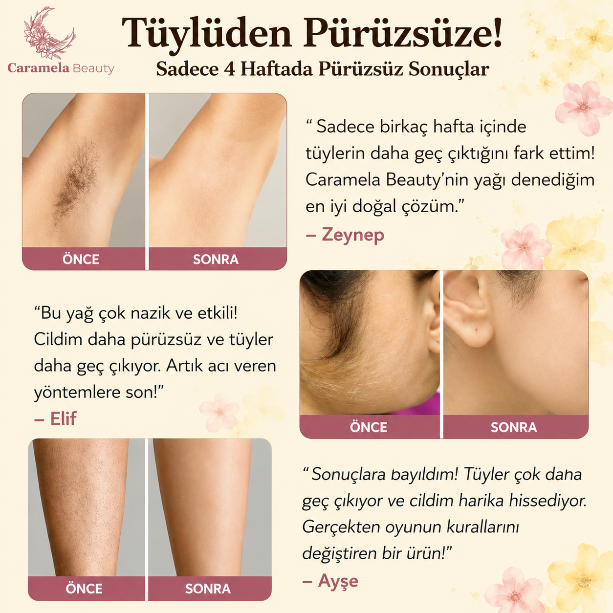 Tüylerle Vedalaşmanın Yeni Yolu | Kıbrıs Kuyruklu Yağı
