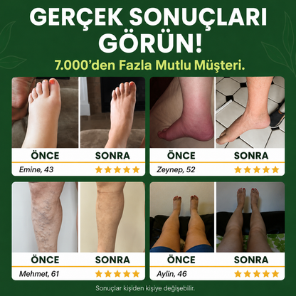 Sorviq Mucize Balsamı™ | Bitkisel Bacak Bakım Balsamı