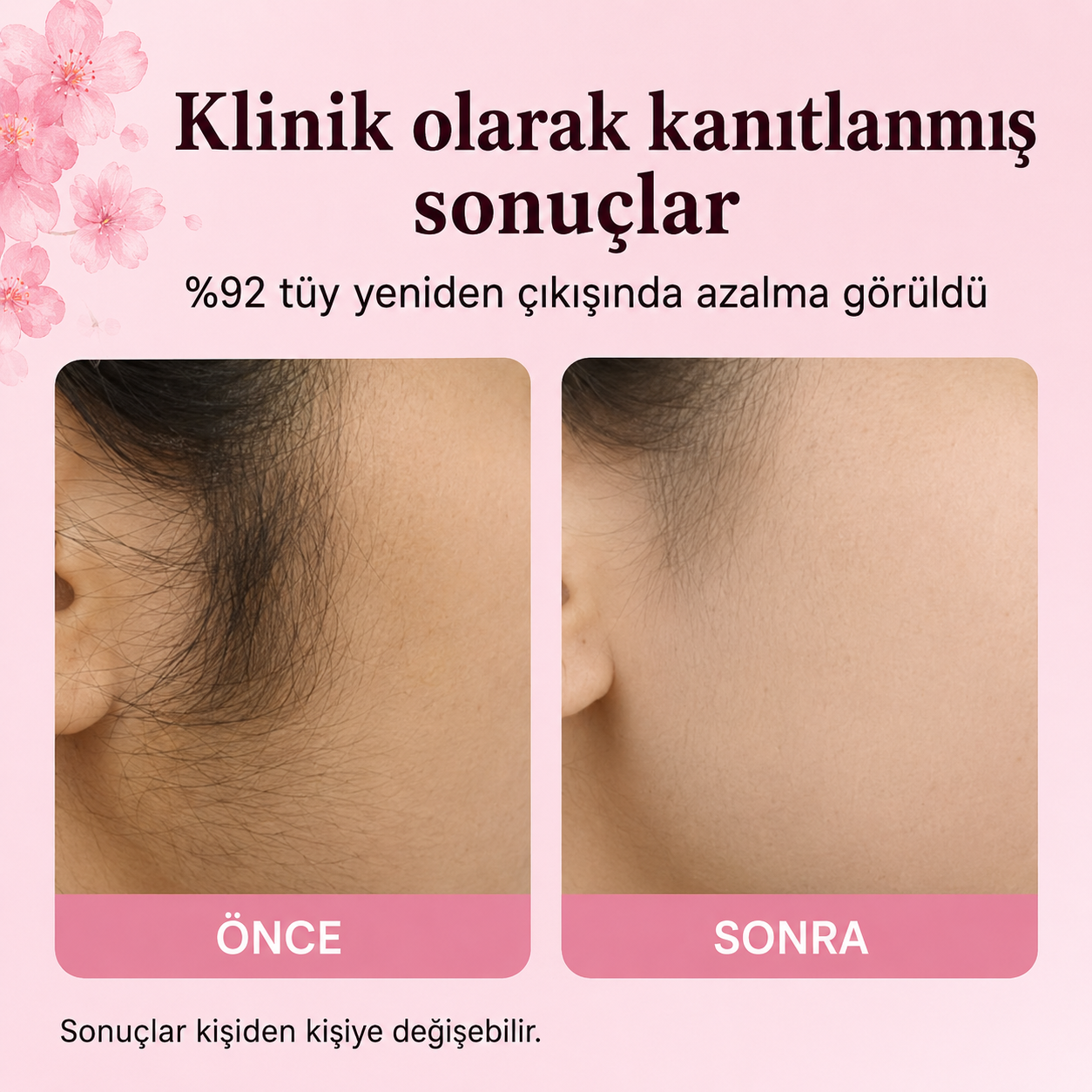 Tüylerle Vedalaşmanın Yeni Yolu | Kıbrıs Kuyruklu Yağı