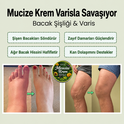 Sorviq Mucize Balsamı™ | Bitkisel Bacak Bakım Balsamı